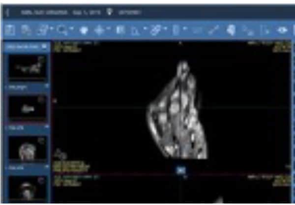 Enterprise Imaging Radiology